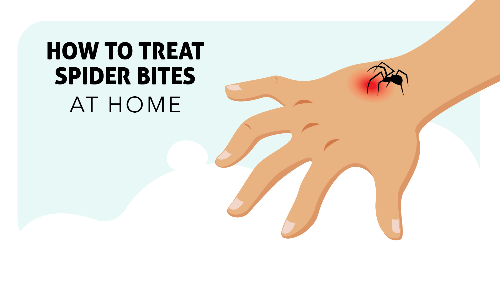 Spider Bite. Effective Treatment & Supplements for Spider Bites